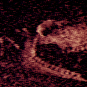 铁肺游戏单机版